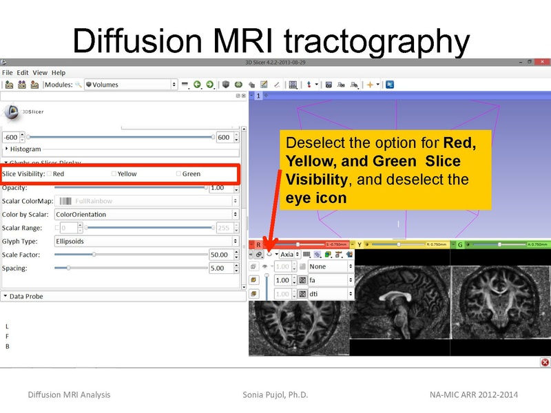 File:DiffusionMRIanalysis Tutorial SoniaPujol 2013.pdf