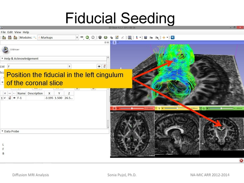 File:DiffusionMRIanalysis Tutorial SoniaPujol 2013.pdf
