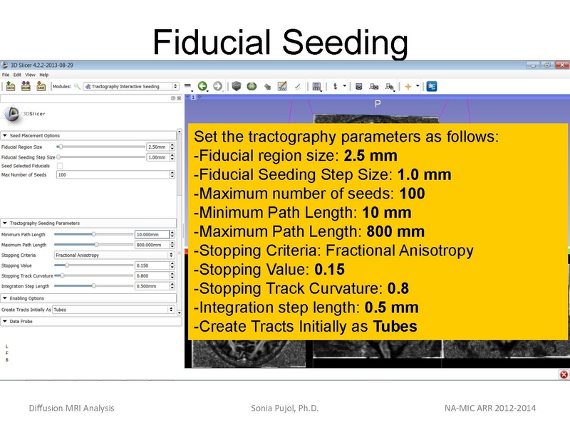 File:DiffusionMRIanalysis Tutorial SoniaPujol 2013.pdf