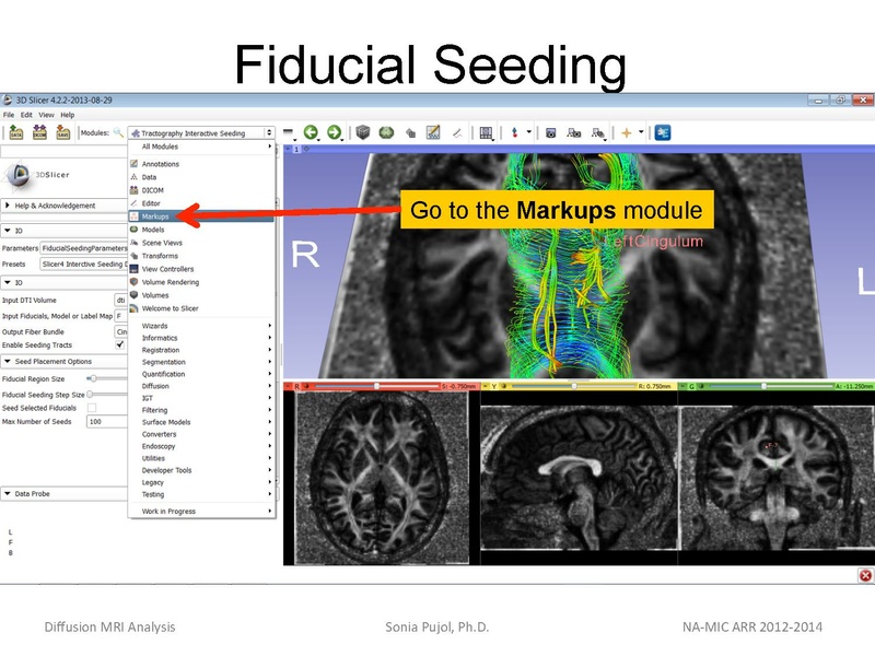 File:DiffusionMRIanalysis Tutorial SoniaPujol 2013.pdf