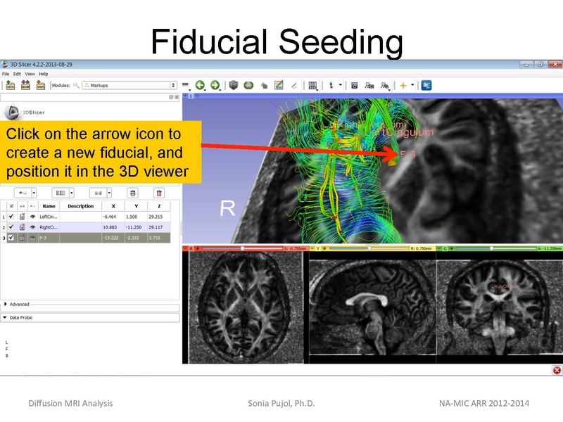 File:DiffusionMRIanalysis Tutorial SoniaPujol 2013.pdf