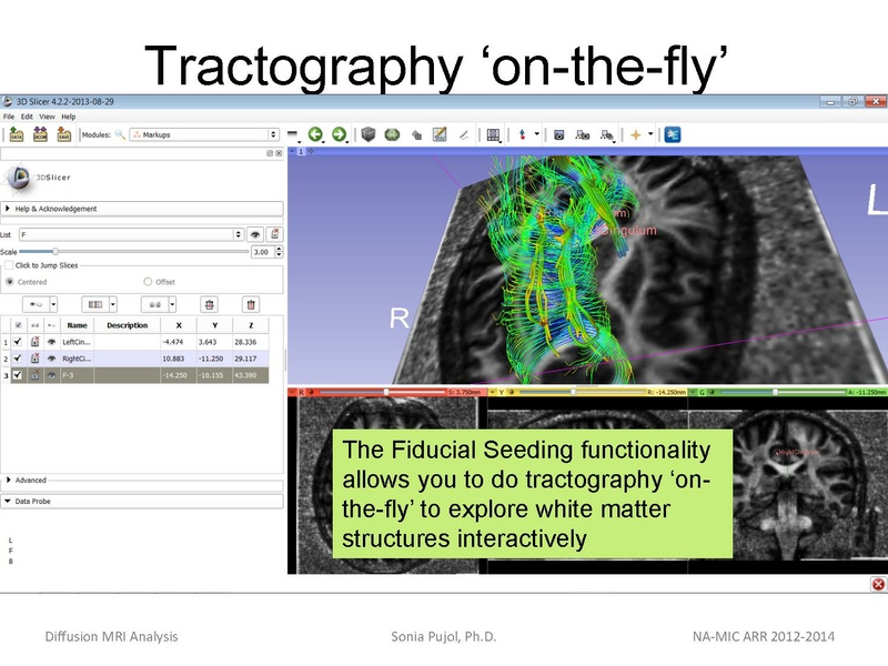 File:DiffusionMRIanalysis Tutorial SoniaPujol 2013.pdf