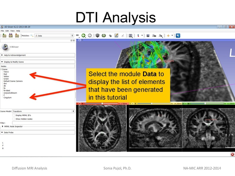 File:DiffusionMRIanalysis Tutorial SoniaPujol 2013.pdf