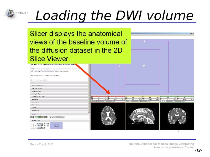 File:DiffusionMRITutorial SFN2009 SPujol.pdf