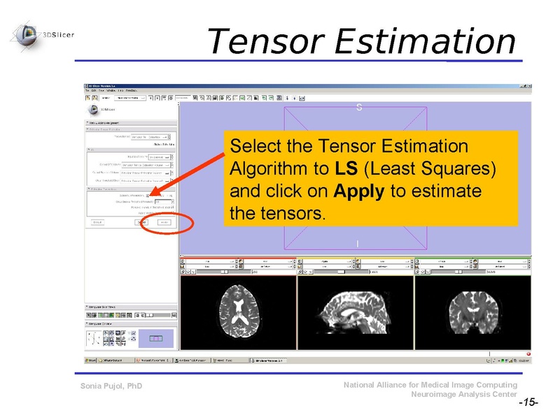 File:DiffusionMRITutorial SFN2009 SPujol.pdf