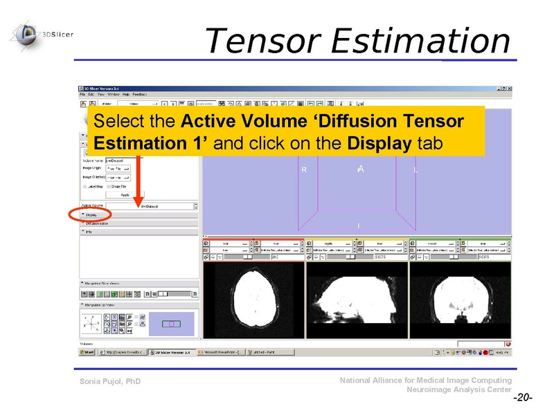 File:DiffusionMRITutorial SFN2009 SPujol.pdf