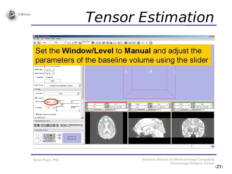 File:DiffusionMRITutorial SFN2009 SPujol.pdf