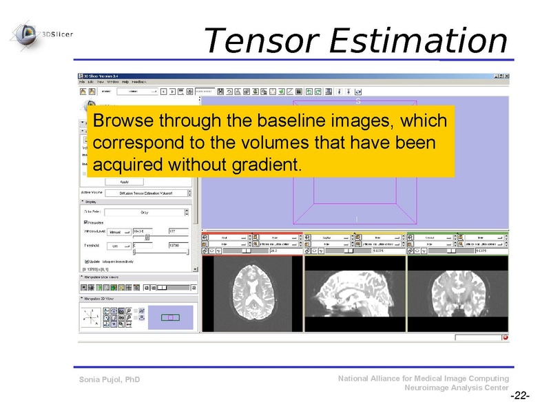 File:DiffusionMRITutorial SFN2009 SPujol.pdf