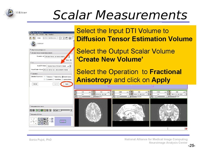 File:DiffusionMRITutorial SFN2009 SPujol.pdf