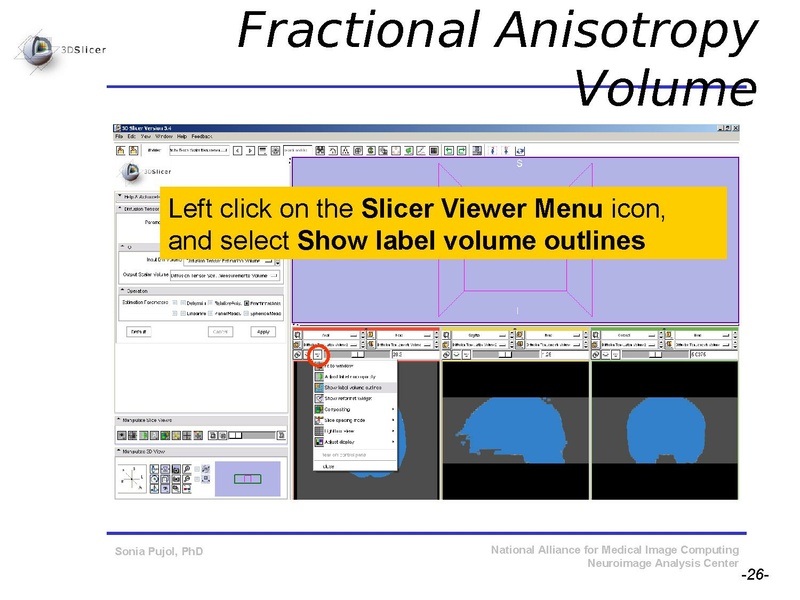 File:DiffusionMRITutorial SFN2009 SPujol.pdf
