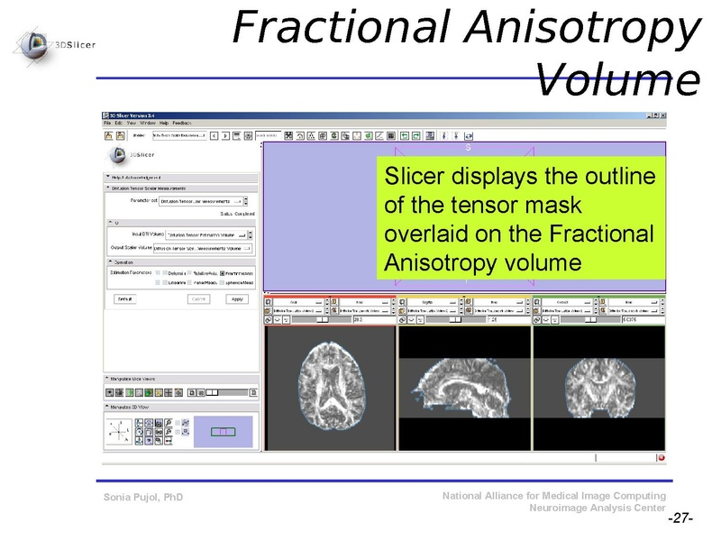 File:DiffusionMRITutorial SFN2009 SPujol.pdf