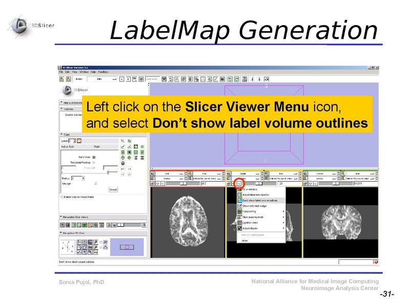 File:DiffusionMRITutorial SFN2009 SPujol.pdf