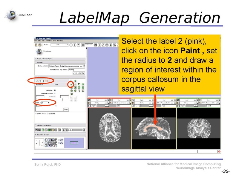 File:DiffusionMRITutorial SFN2009 SPujol.pdf
