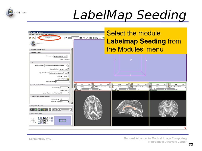 File:DiffusionMRITutorial SFN2009 SPujol.pdf