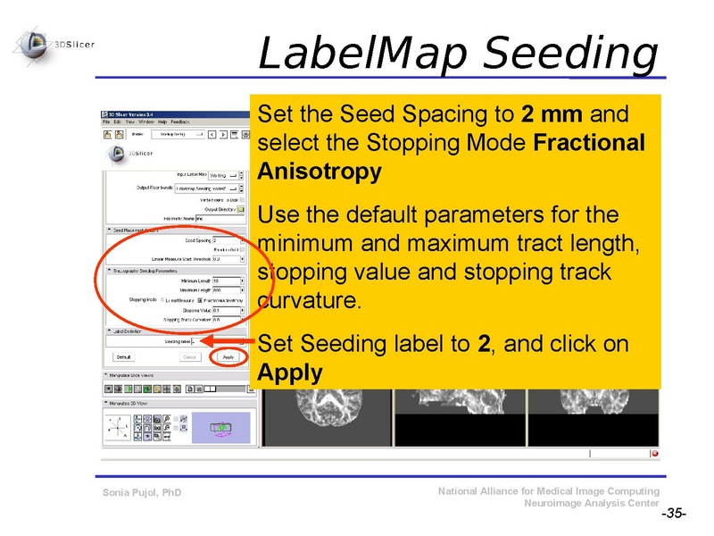 File:DiffusionMRITutorial SFN2009 SPujol.pdf