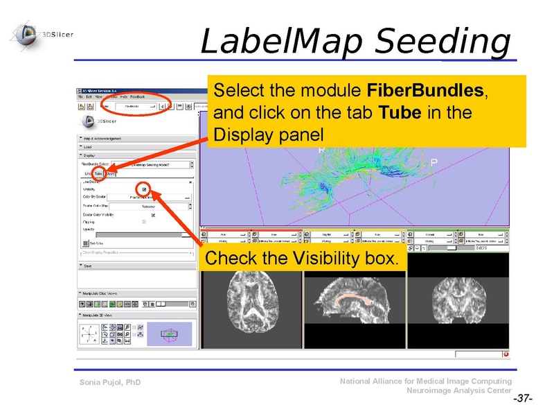 File:DiffusionMRITutorial SFN2009 SPujol.pdf