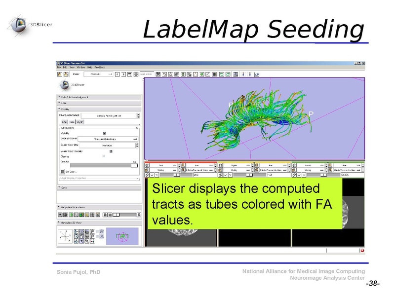 File:DiffusionMRITutorial SFN2009 SPujol.pdf