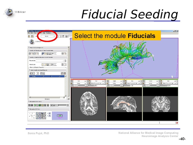 File:DiffusionMRITutorial SFN2009 SPujol.pdf