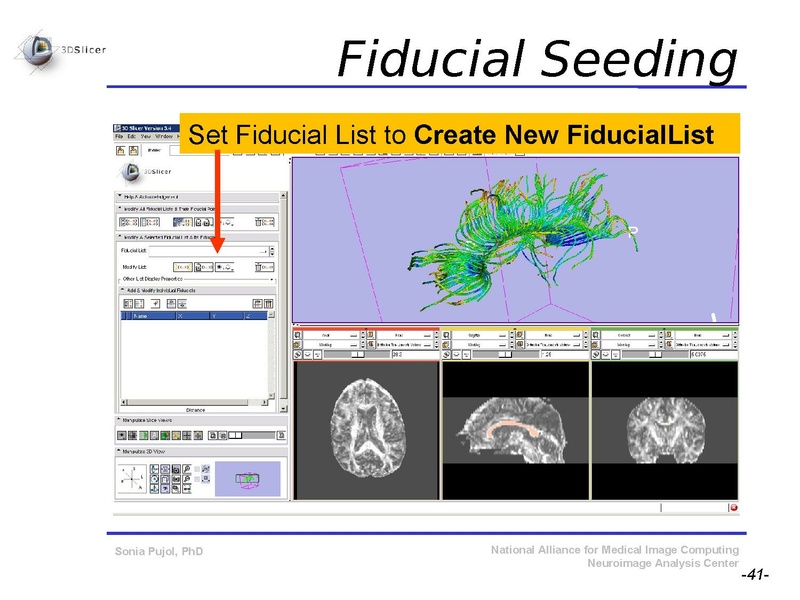 File:DiffusionMRITutorial SFN2009 SPujol.pdf