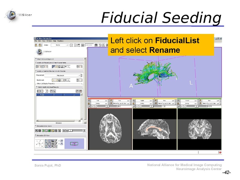 File:DiffusionMRITutorial SFN2009 SPujol.pdf