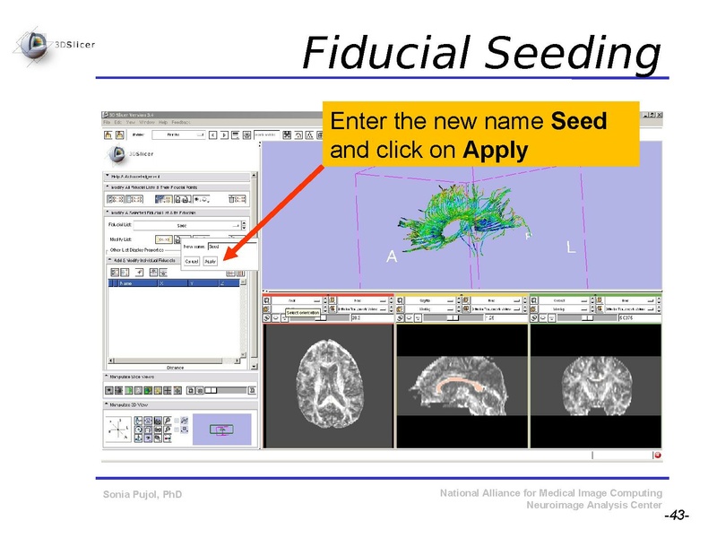 File:DiffusionMRITutorial SFN2009 SPujol.pdf