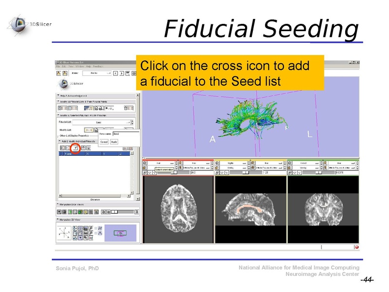 File:DiffusionMRITutorial SFN2009 SPujol.pdf