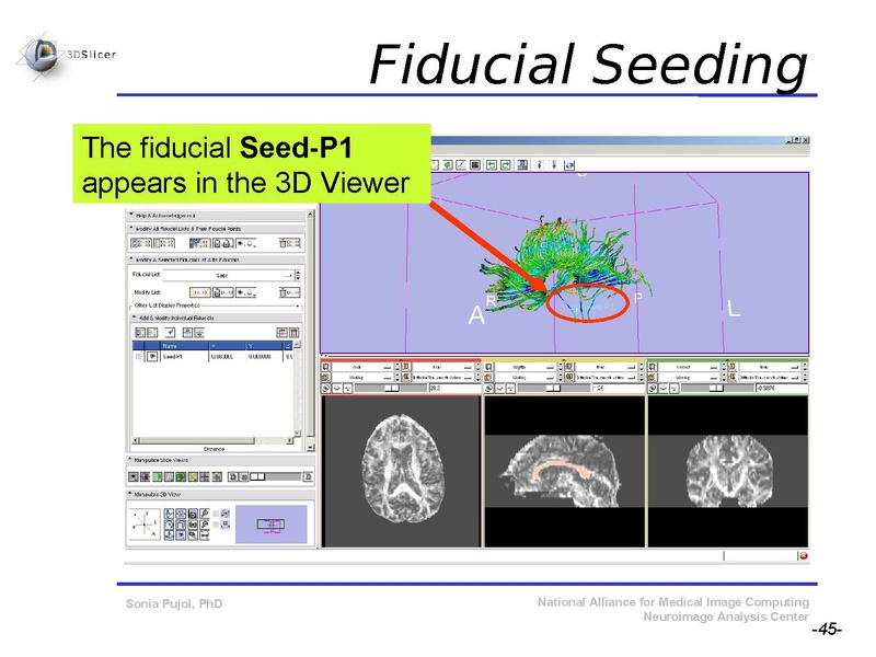 File:DiffusionMRITutorial SFN2009 SPujol.pdf