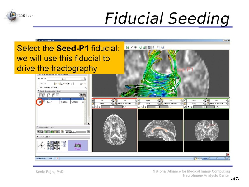 File:DiffusionMRITutorial SFN2009 SPujol.pdf