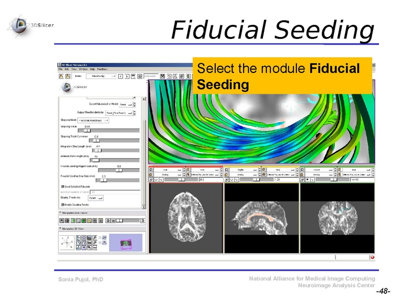 File:DiffusionMRITutorial SFN2009 SPujol.pdf