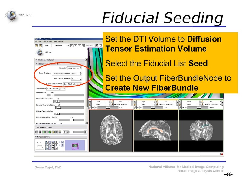 File:DiffusionMRITutorial SFN2009 SPujol.pdf
