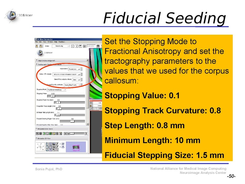 File:DiffusionMRITutorial SFN2009 SPujol.pdf