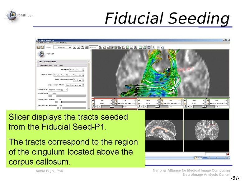 File:DiffusionMRITutorial SFN2009 SPujol.pdf