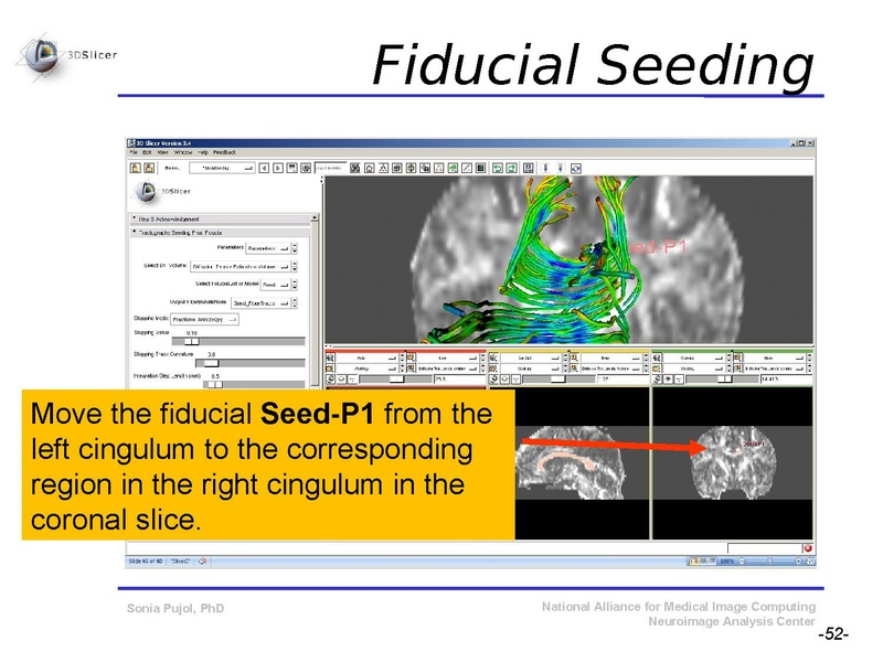 File:DiffusionMRITutorial SFN2009 SPujol.pdf