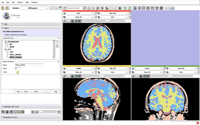 File:EMSegmentation Results Screenshot.png