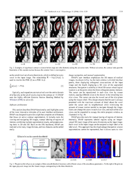 File:Yushkevich-Neuroimage2006.pdf