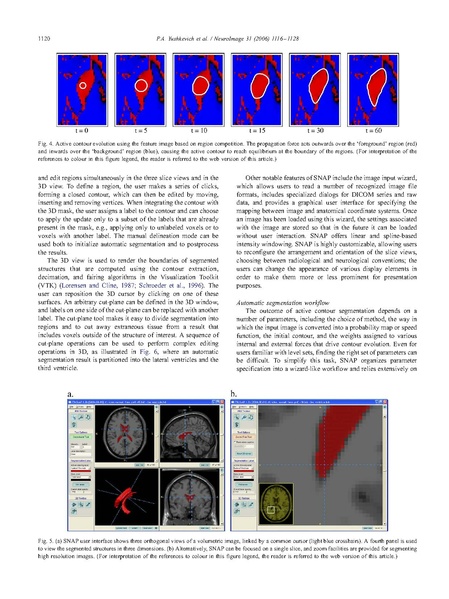 File:Yushkevich-Neuroimage2006.pdf