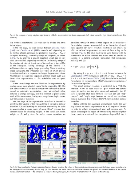File:Yushkevich-Neuroimage2006.pdf