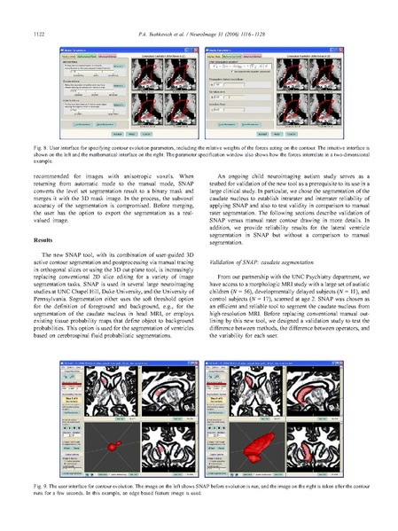 File:Yushkevich-Neuroimage2006.pdf