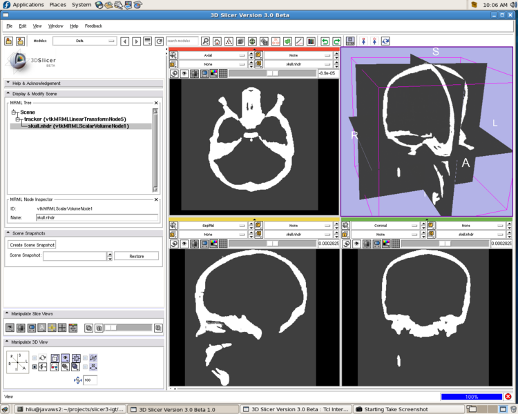 File:Slicer TrackerDaemon IGSTK.png