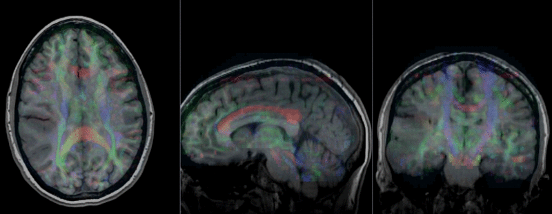 File:RegLib C29 registered.gif