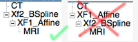 example of nested transforms for an affine followed by a BSpline. Note that the order matters