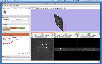 Slicer3 ProstateNav ZFrameRegistration.png