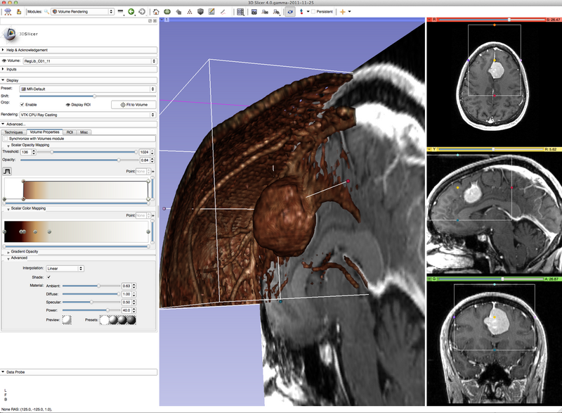 File:Tumor-Volume-Rendering-PostGad-2011.png