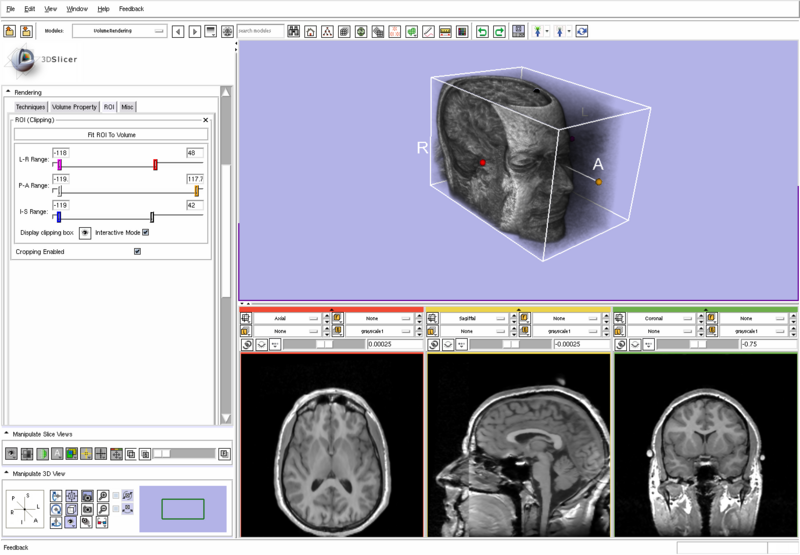 File:VtkGPURayCasting-Clipping.png