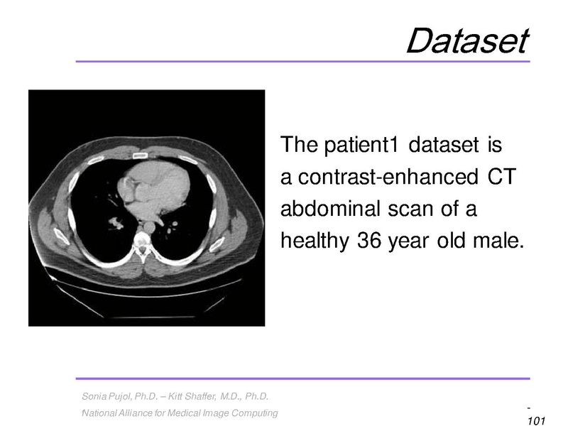 File:3DVisualization SoniaPujol RSNA2009 11-30-2009.pdf