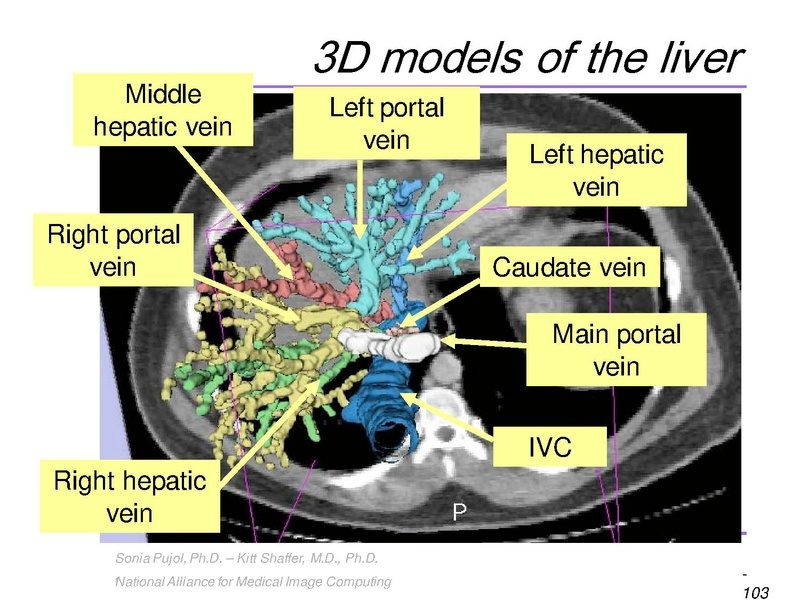 File:3DVisualization SoniaPujol RSNA2009 11-30-2009.pdf