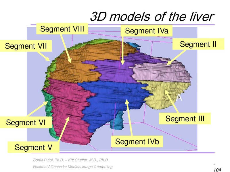 File:3DVisualization SoniaPujol RSNA2009 11-30-2009.pdf