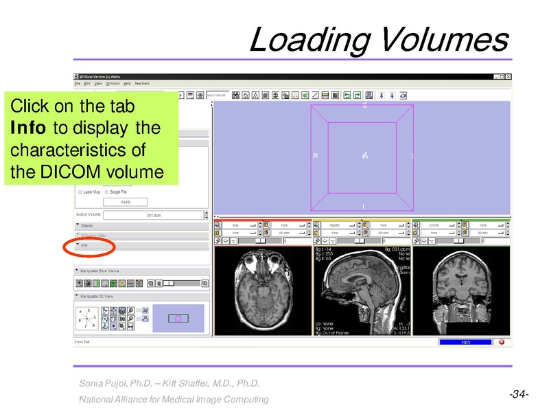 File:3DVisualization SoniaPujol RSNA2009 11-30-2009.pdf