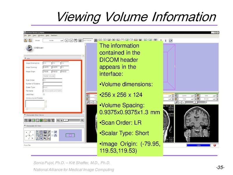File:3DVisualization SoniaPujol RSNA2009 11-30-2009.pdf
