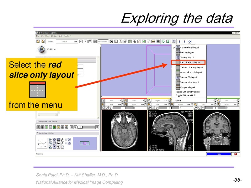 File:3DVisualization SoniaPujol RSNA2009 11-30-2009.pdf